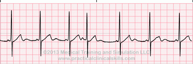 EKG Practice Drill