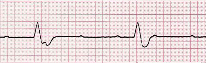 EKG Interpretation Coaching