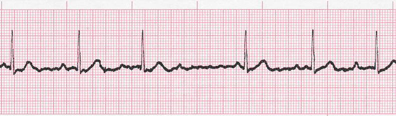 Ekg Practice Drill