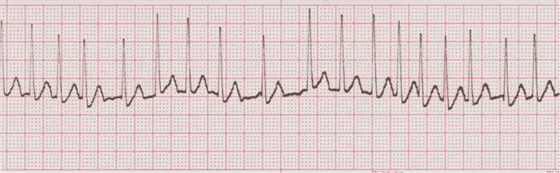 ECG Practice Drill