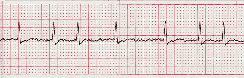 EKG Practice Drill