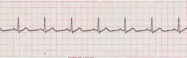 ECG Practice Drill