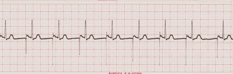 EKG - Estos ejercicios prácticos 