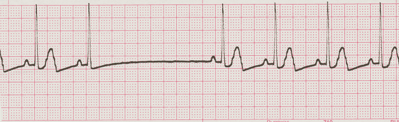 ECG Practice Drill