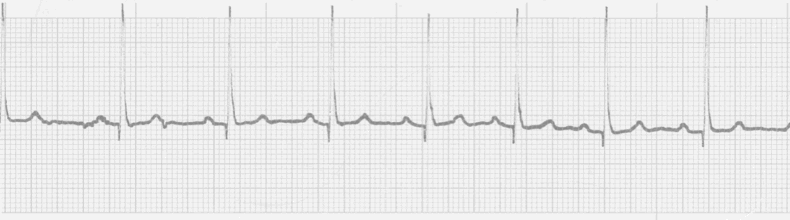 EKG - Estos ejercicios prácticos 