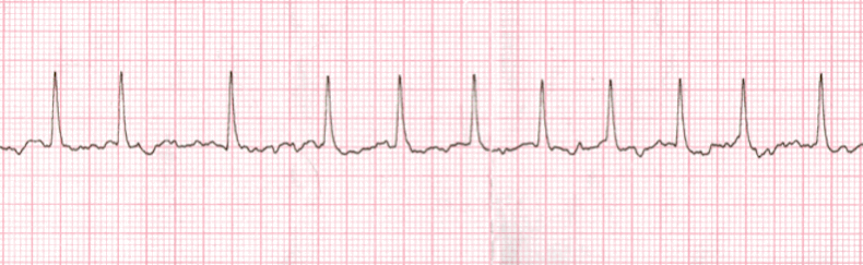 EKG Practice Drill