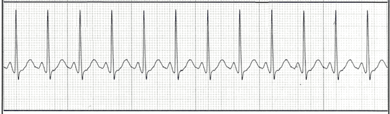 EKG Practice Drill