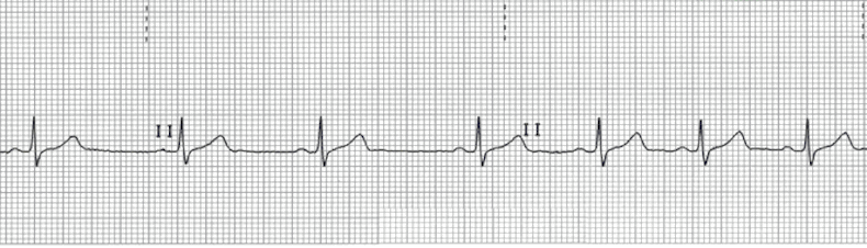 ECG Practice Drill