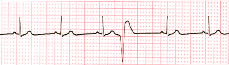 ECG Practice Drill