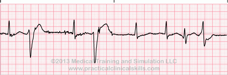 ECG Practice Drill