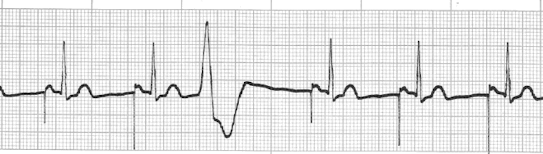 ECG Practice Drill