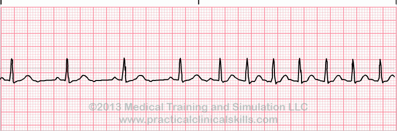 EKG - Estos ejercicios prácticos 