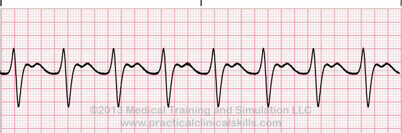 EKG Practice Drill