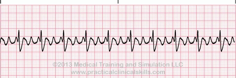 EKG Practice Drill