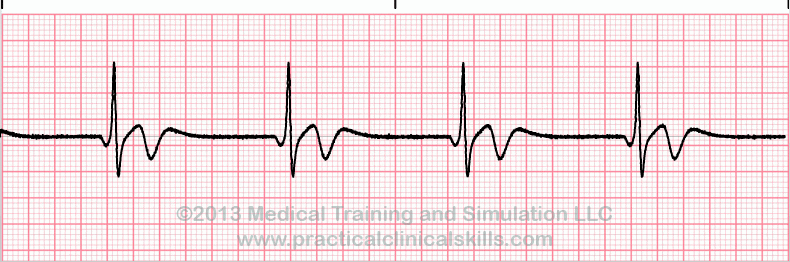 ECG Practice Drill